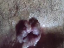 mi lindo anal