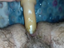Anal solitario